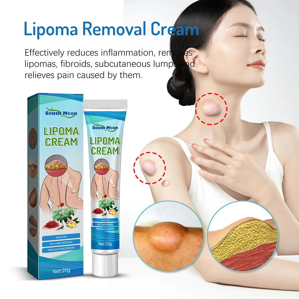 Крем lipoma для удаления липолиза