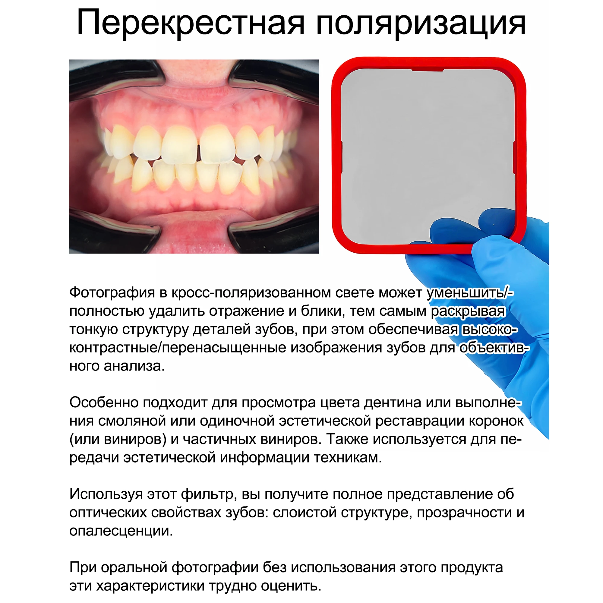 Лучший свет для дентальной фотографии - Фотография_6