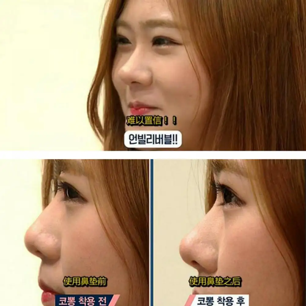 Корректор носа, инструмент для - Фотография_4