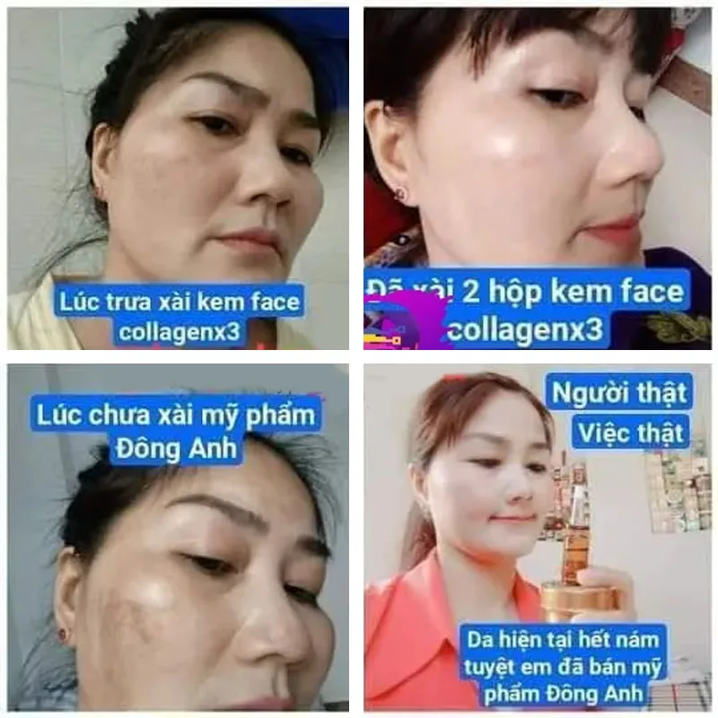 Облицо коллаген x3 tinh diel collagen 남성ския teksto] - Фотография_4