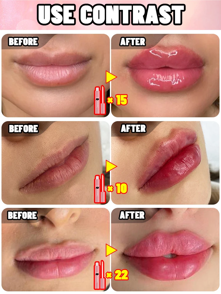 От тонких губ до полных губ - Фотография_3