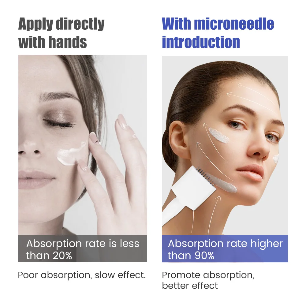 Derma stamp microneedling роликовый - Фотография_5