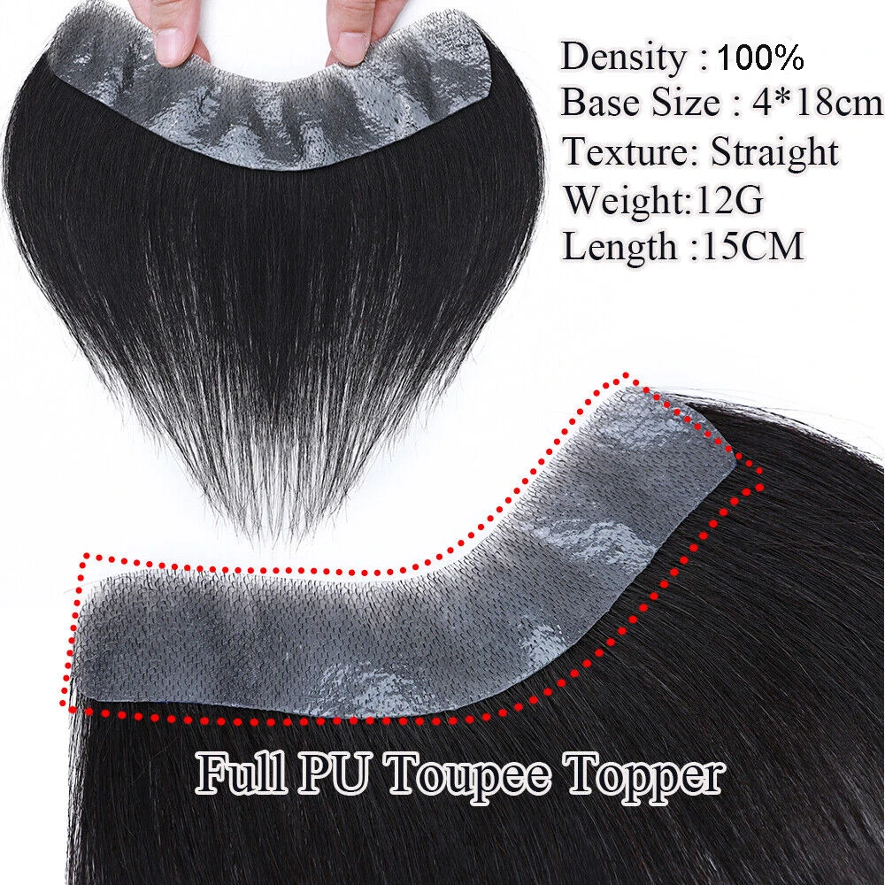 Invisble hairline v стиль передний - Фотография_2