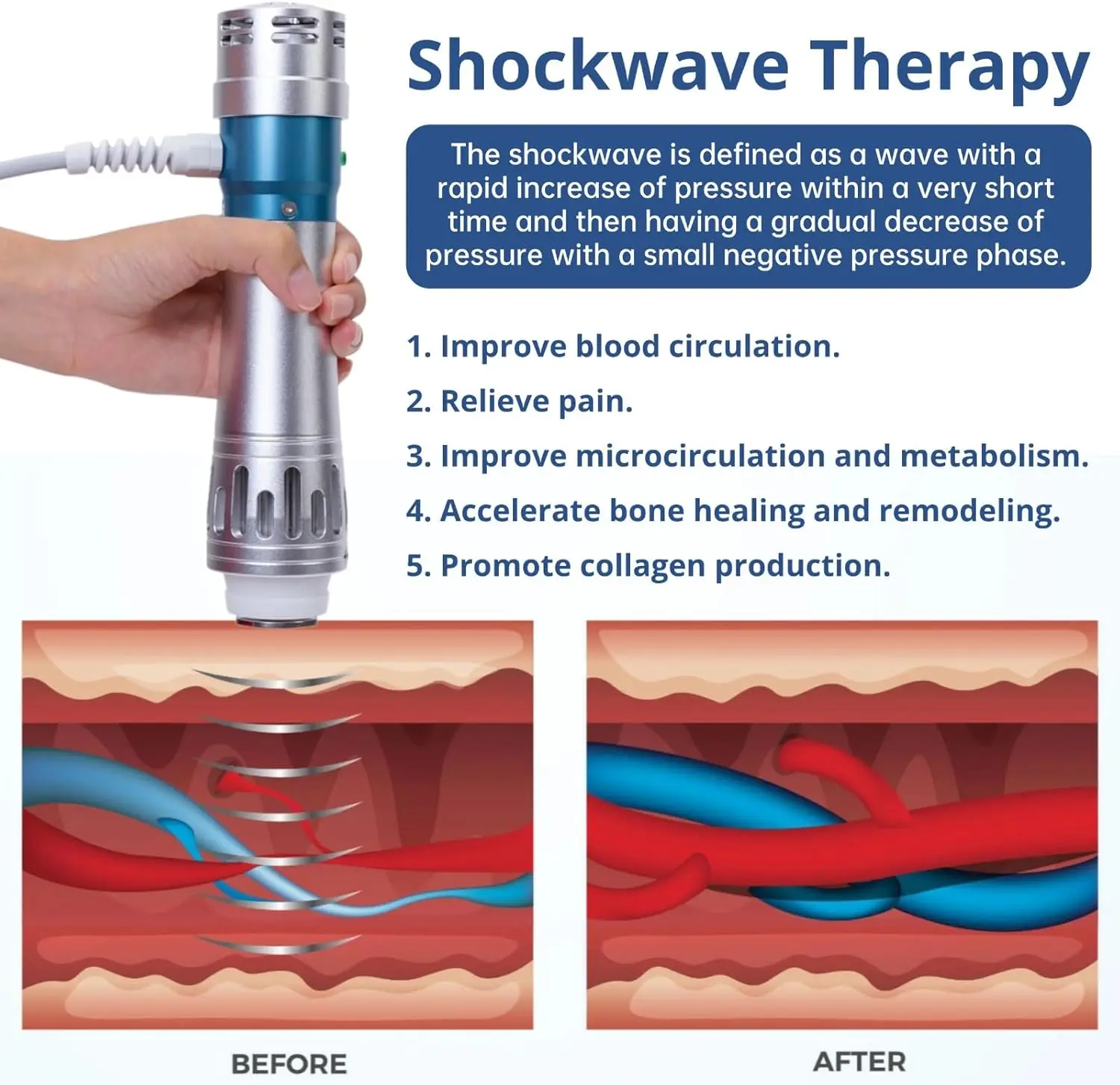 Аппарат для ударно-волновой терапии - Фотография_3