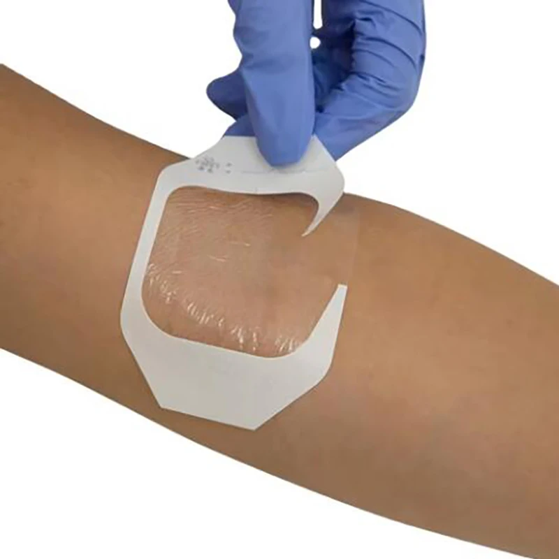 Медицинских средств i.v. инфузионный катетер cannula - Фотография_6