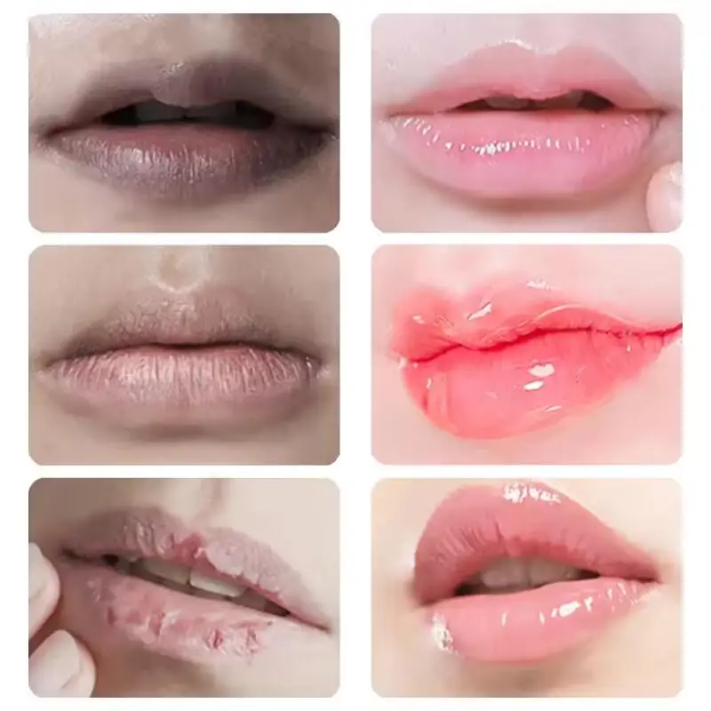 Удаление темных губ бальзам для - Фотография_4