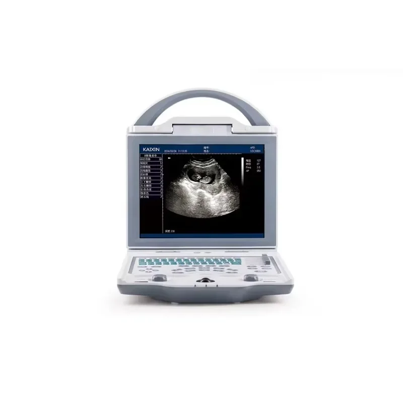 Года портативный ультразвуковой - Фотография_3