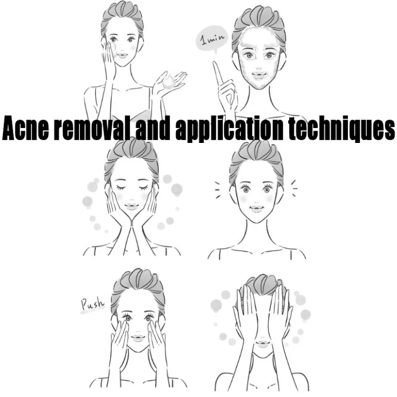 Крем для лица для удаления прыщей и удаления прыщей - Фотография_3