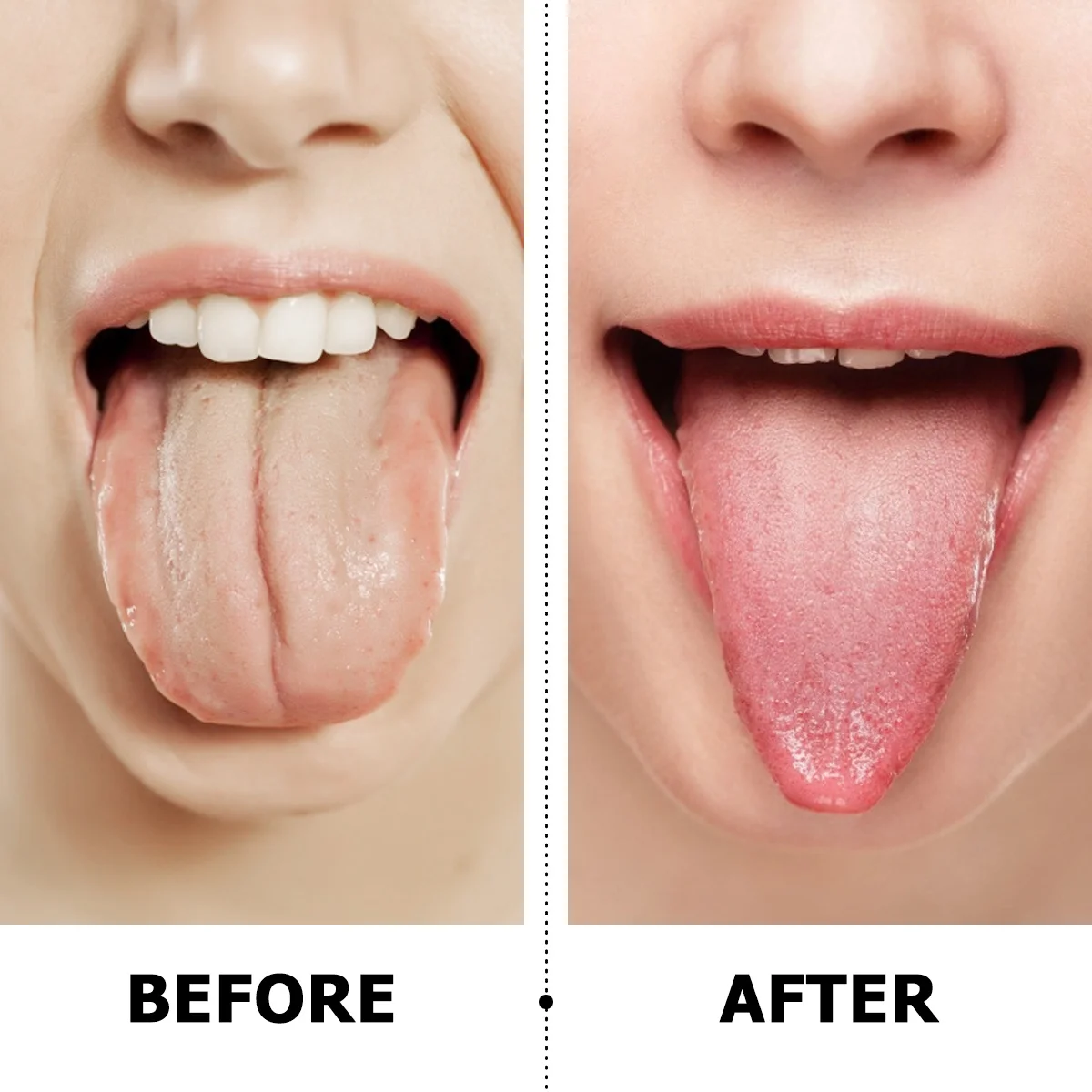 Скребок для языка - Фотография_4