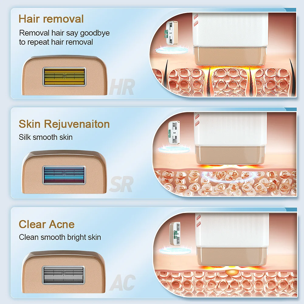 Лазерное удаление волос kinseibeauty ipl - Фотография_3