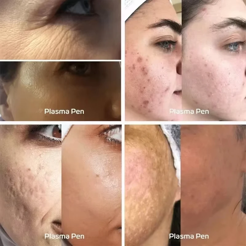 Восновление вашей кожи с помощью - Фотография_6