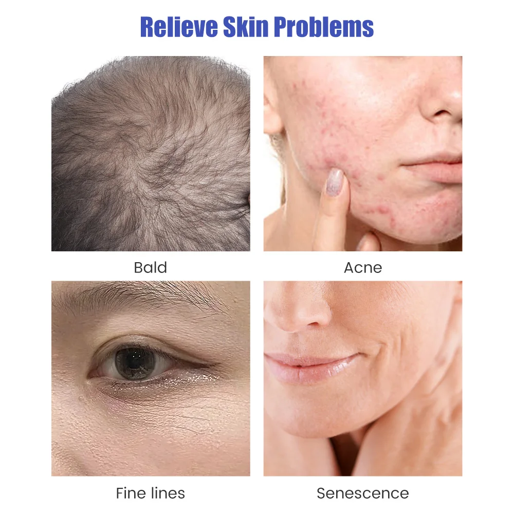 Derma stamp microneedling роликовый - Фотография_3