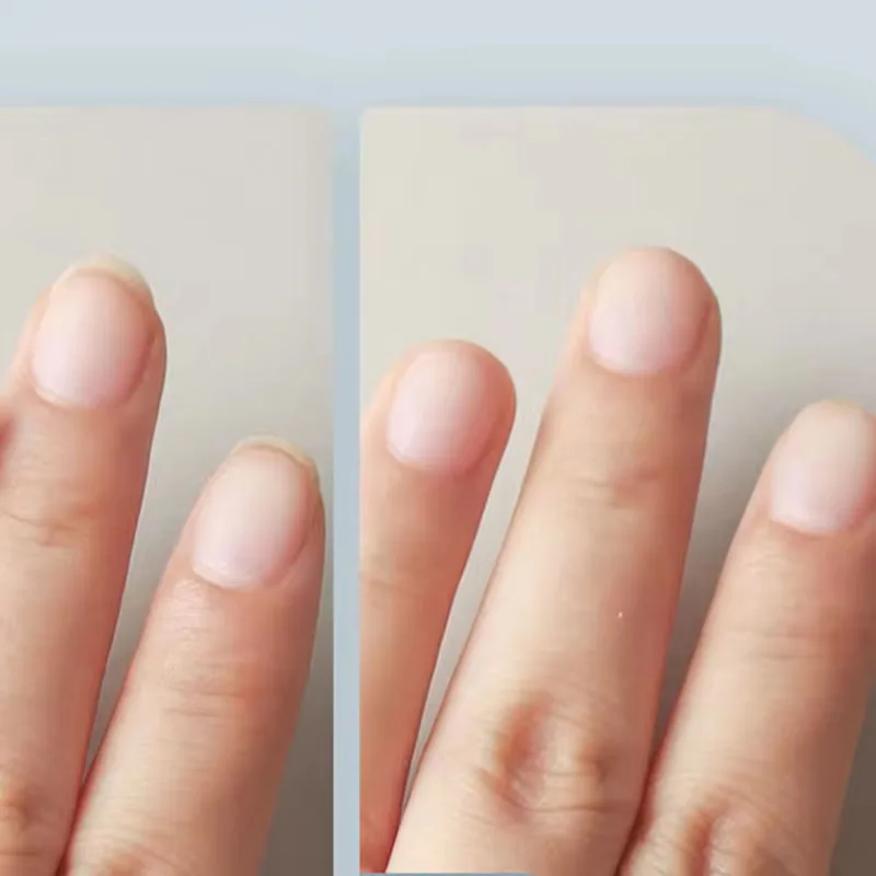 Ножницы для ногтей xiaomi oukeelar - Фотография_3
