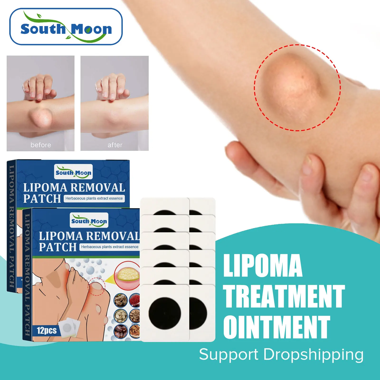 Крем lipoma для удаления целлюлита