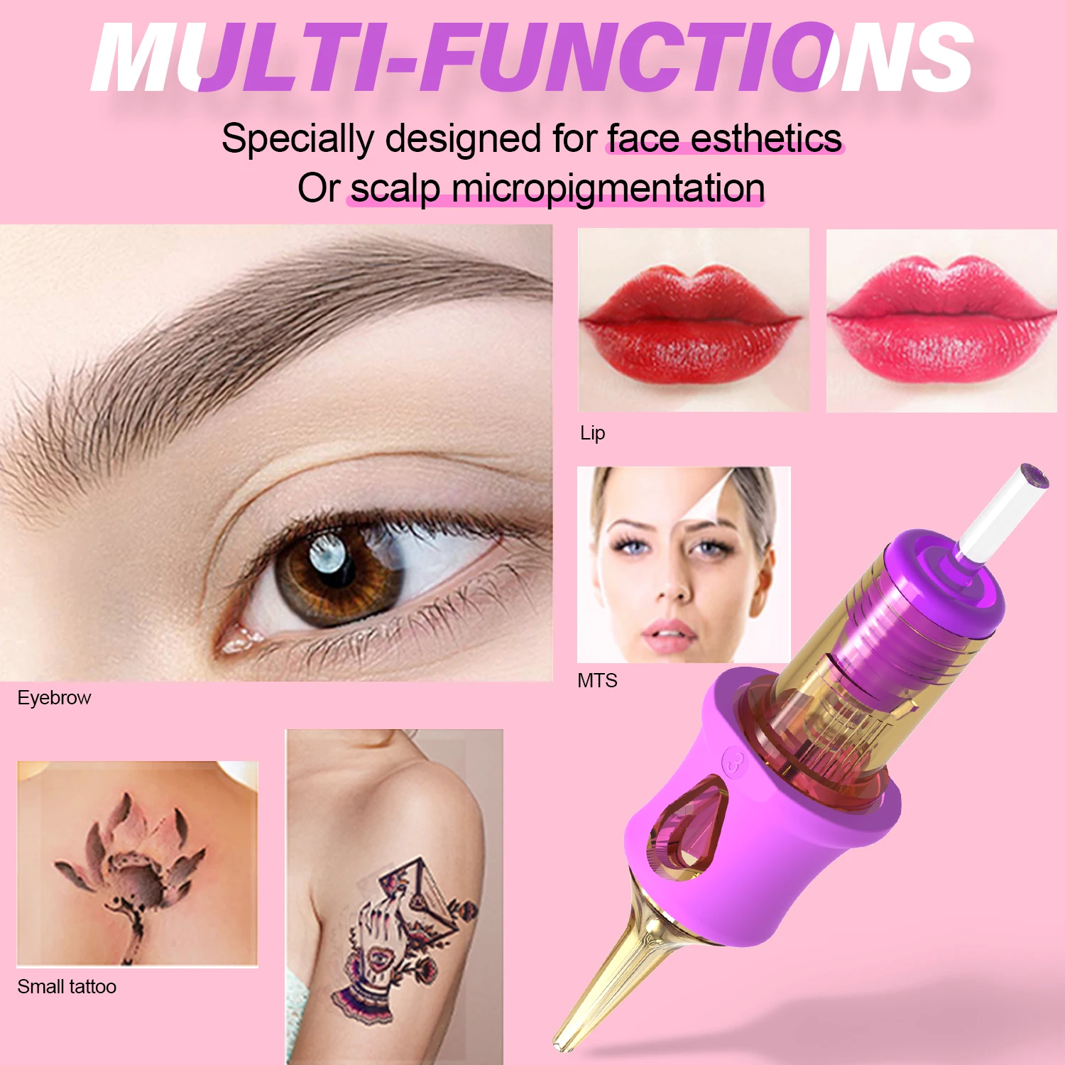 Naom 10pcsnaom pmu стерилизованные - Фотография_3