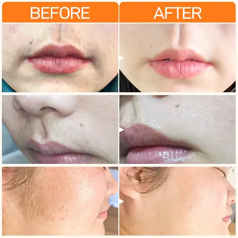 3-хвилинный крем для быстрого удаления волос - Фотография_3