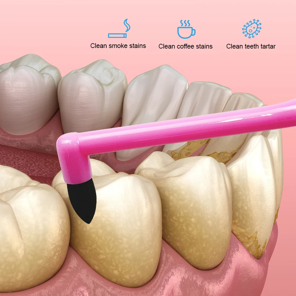 Щетка для чистки зубных пятен - Фотография_6