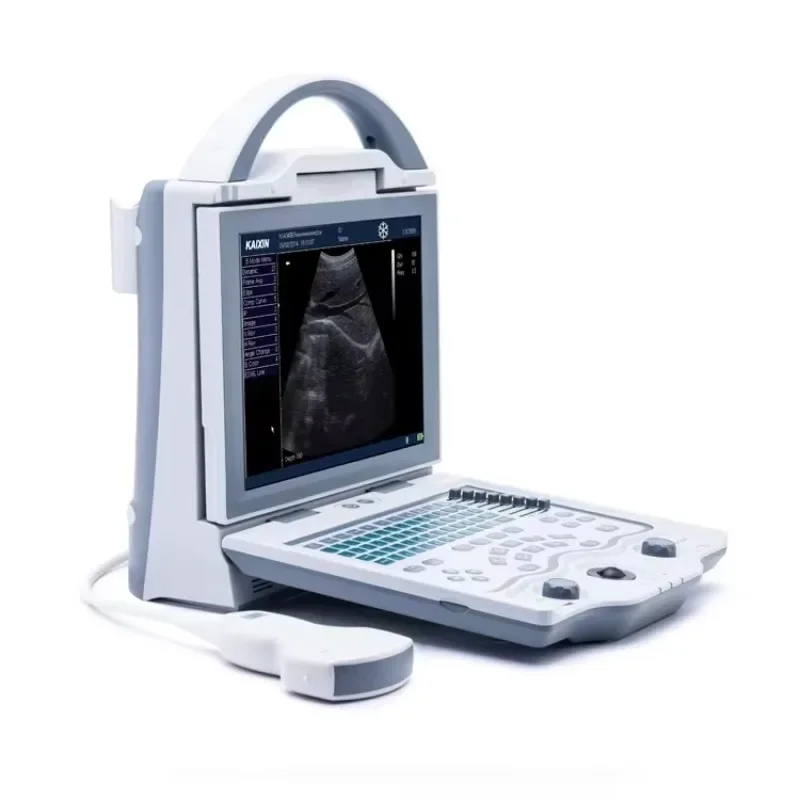 Года портативный ультразвуковой - Фотография_4