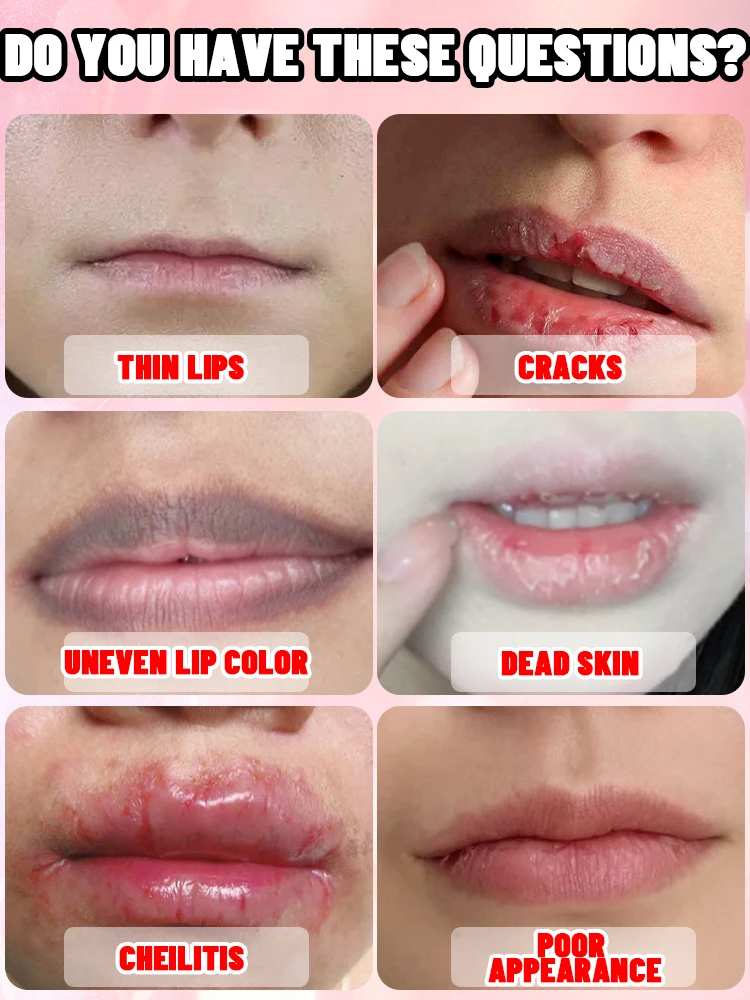 От тонких губ до полных губ - Фотография_5