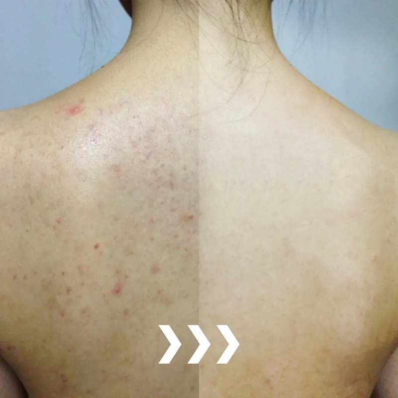 Глюта мастер с витамином c - Фотография_2