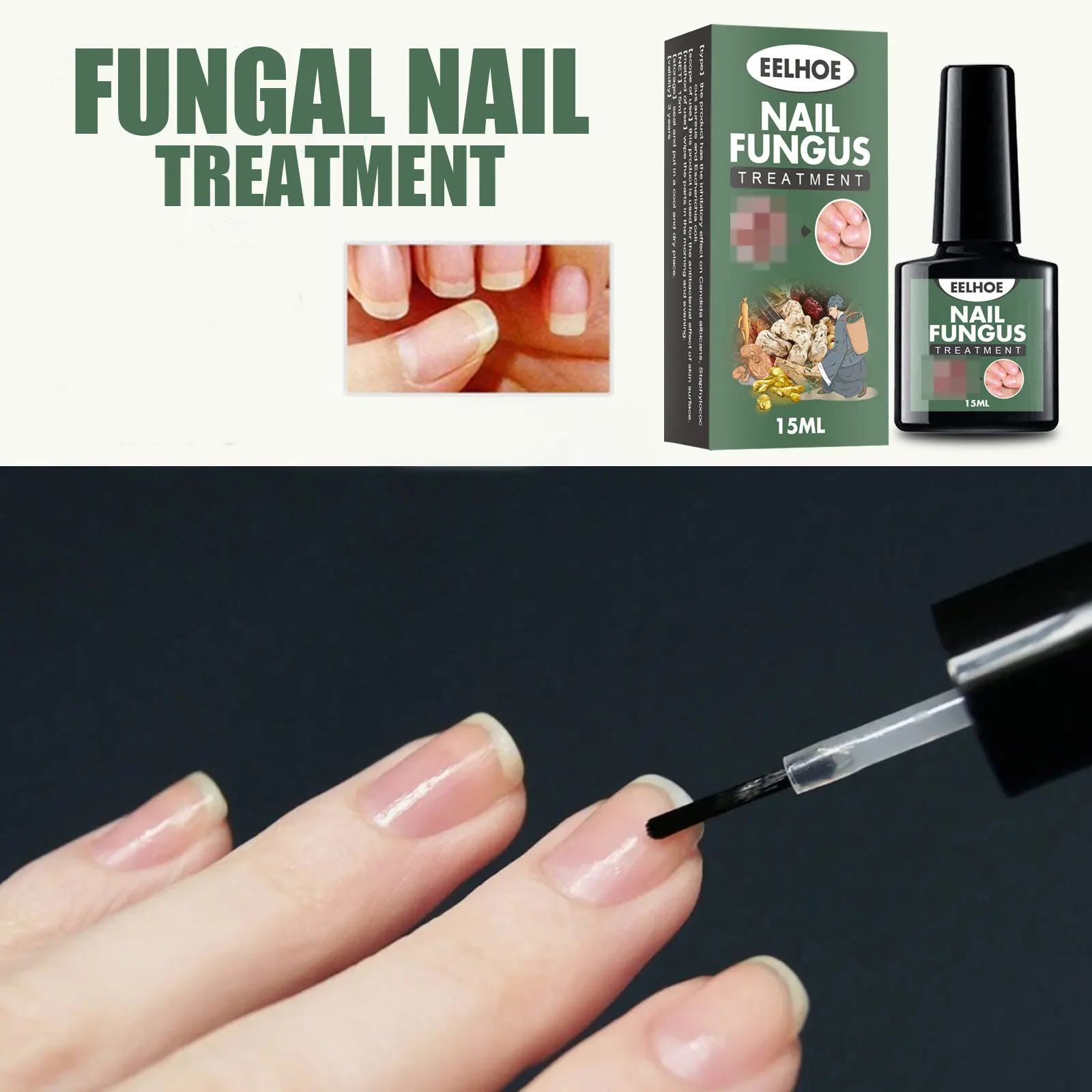 Эссенция для лечения грибка ногтей - Фотография_2