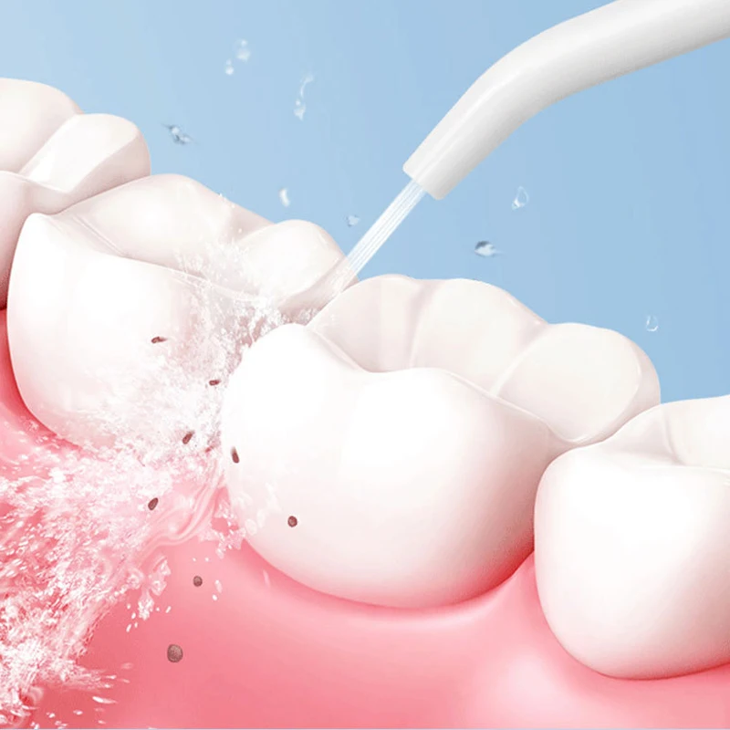 Профессиональный ирригатор для полости рта - Фотография_6