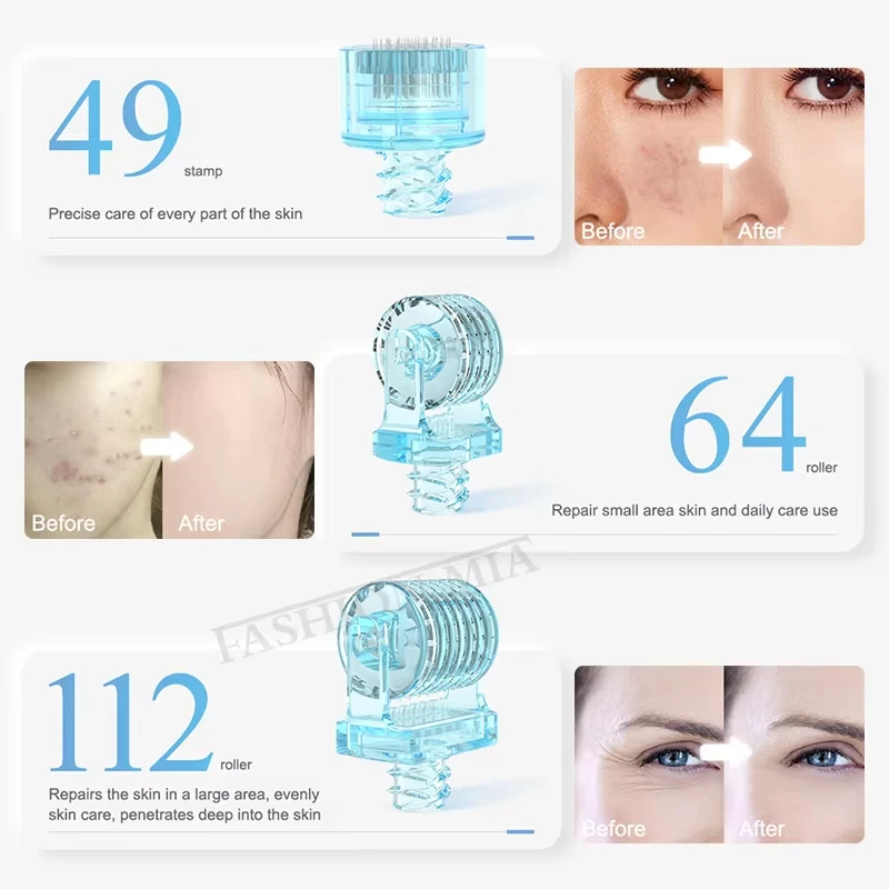 Одноразовые 3 в 1 s1 derma roller - Фотография_5