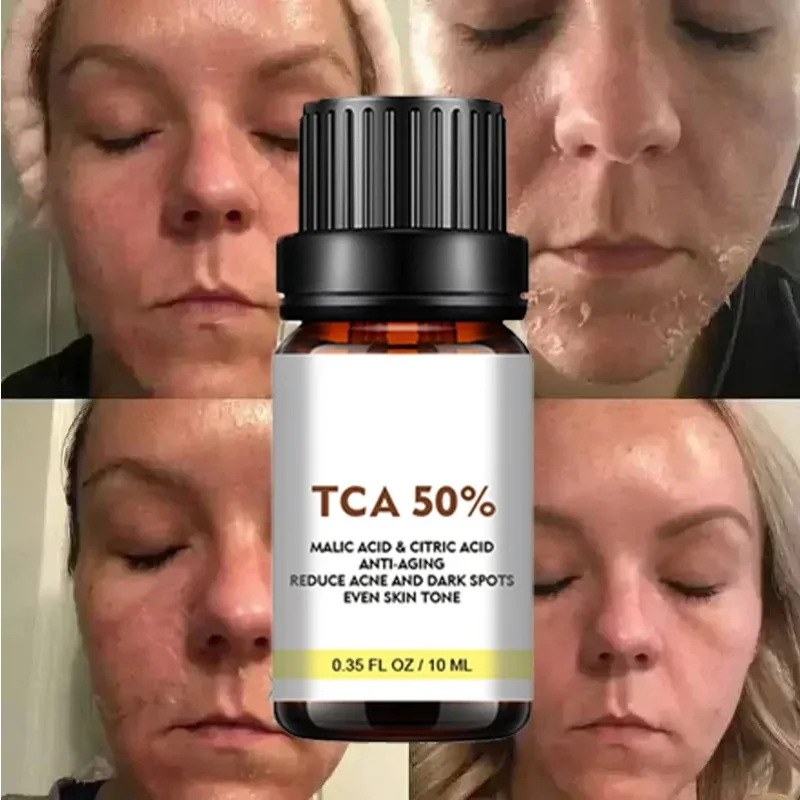 Пилинг для лица с салициловой кислотой - Фотография_2