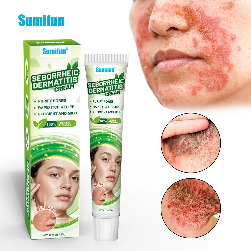 Sumifun крем от себорейного дерматита для удаления перхоти на голове