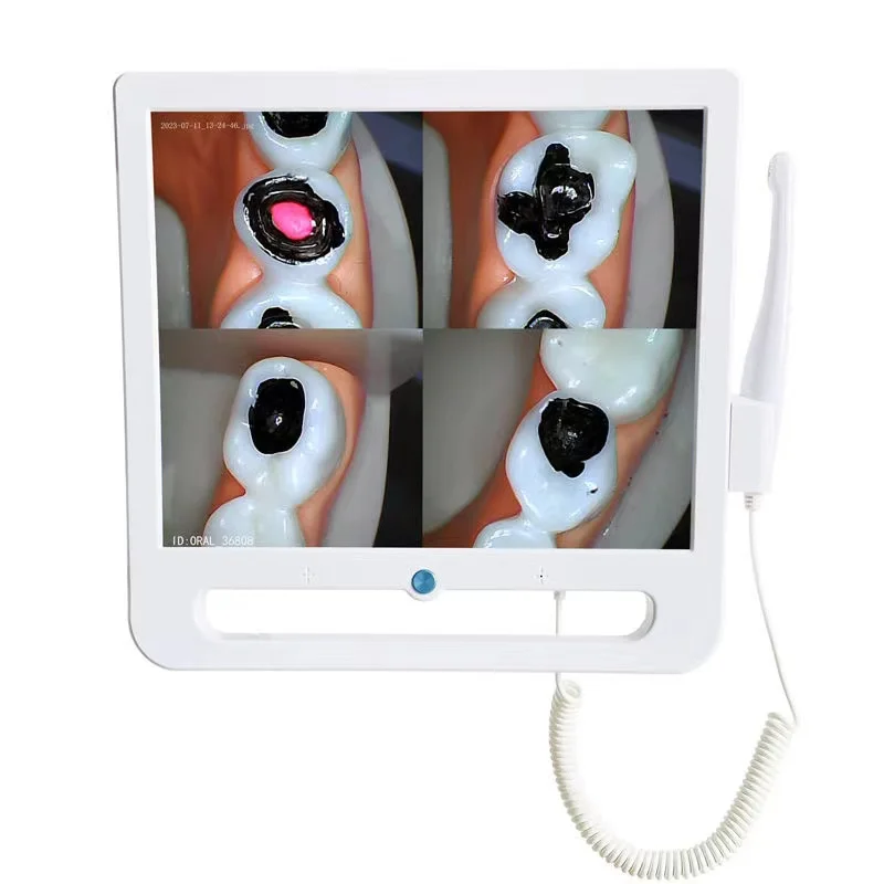 Зубные протезы wi-fi intra oral - Фотография_5