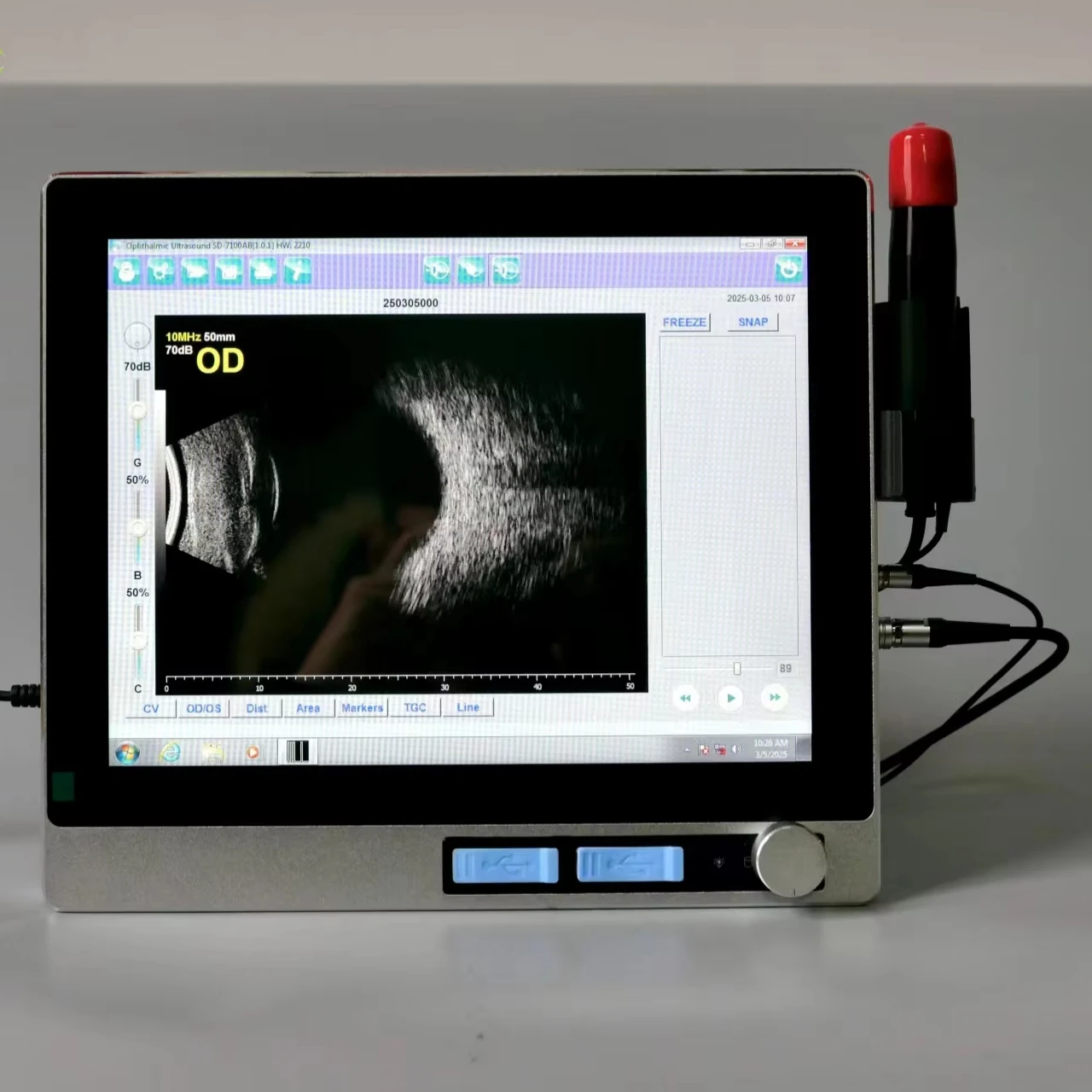 Nv-6000ab офтальмологический ультразвуковой