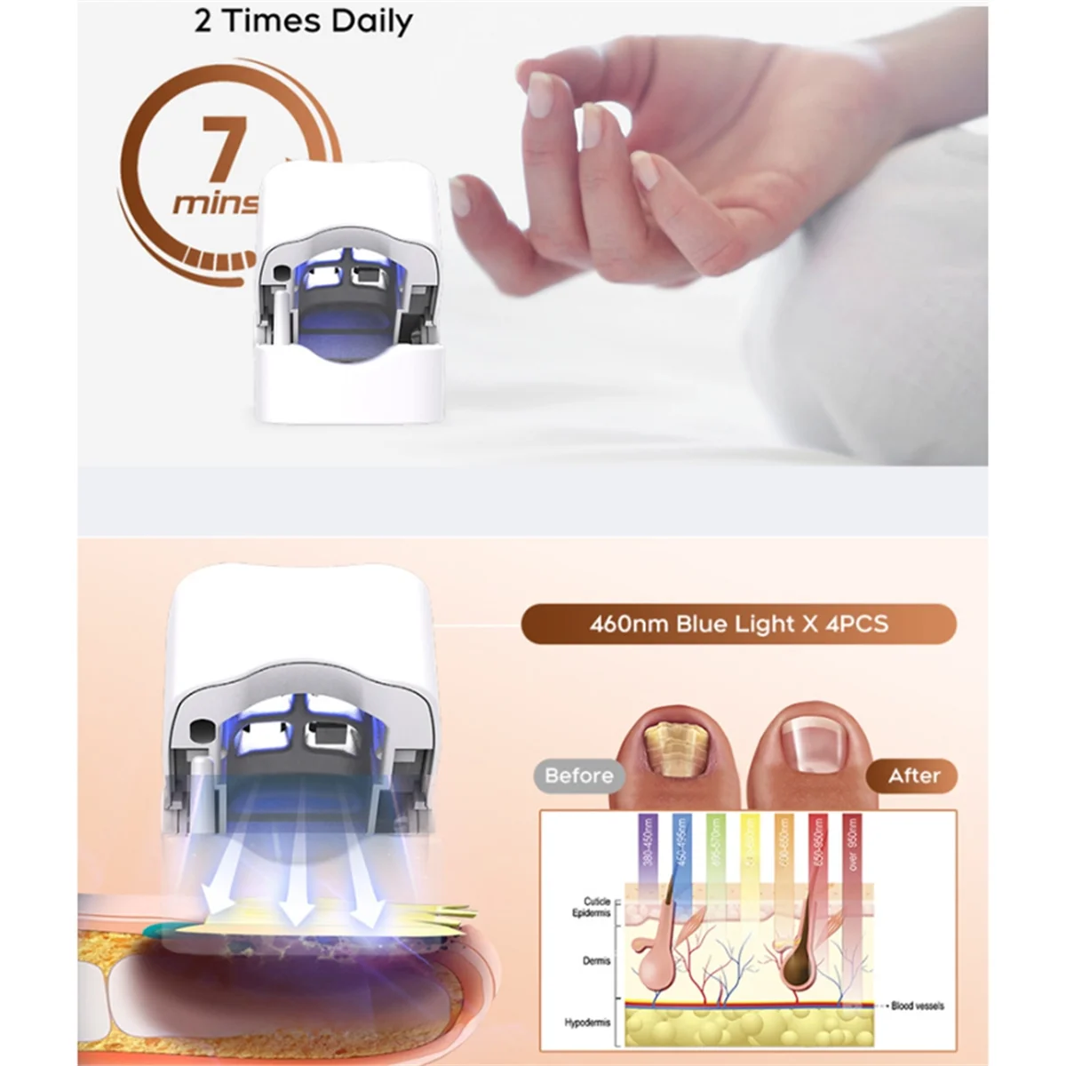 A71p лампа для чистки грибка для - Фотография_5