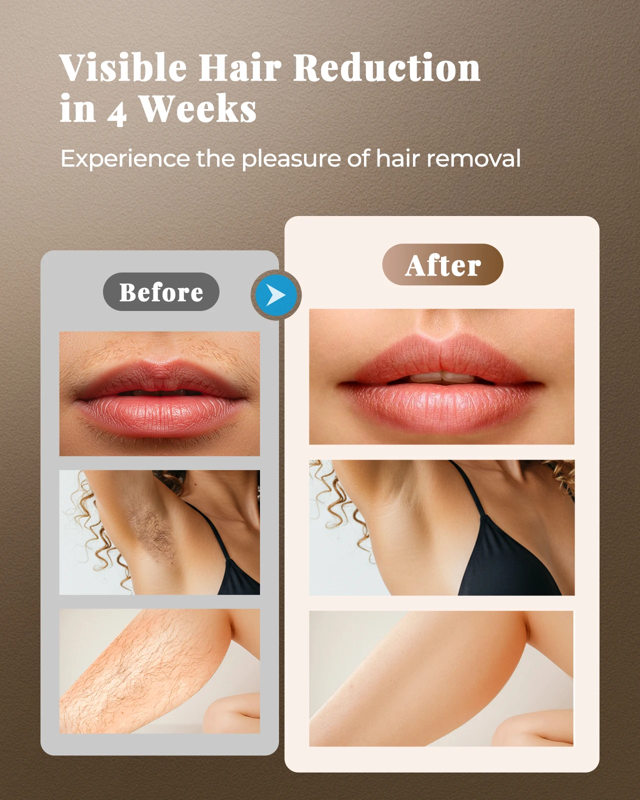 Лазерные устройства для удаления - Фотография_2