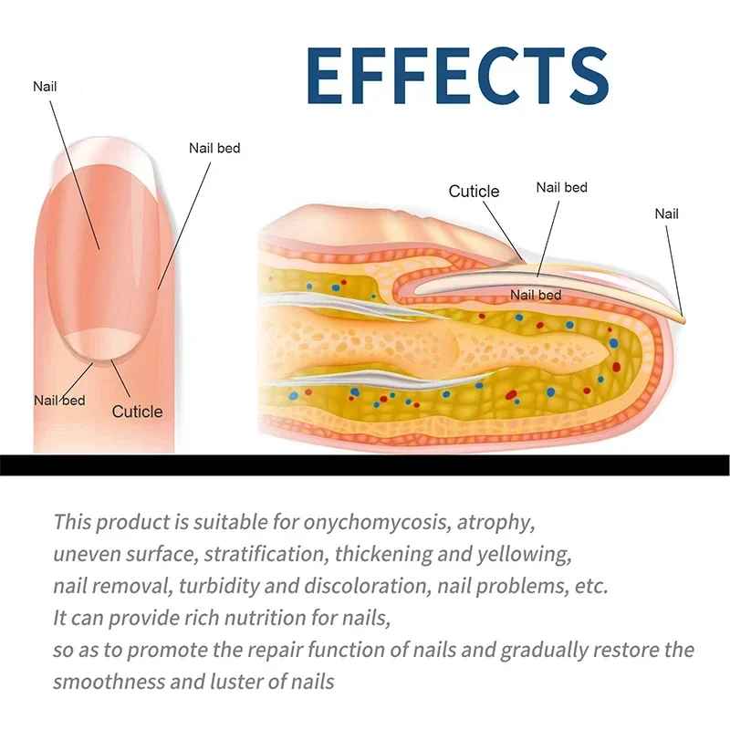 Пластырь для ремонта ногтей - Фотография_2