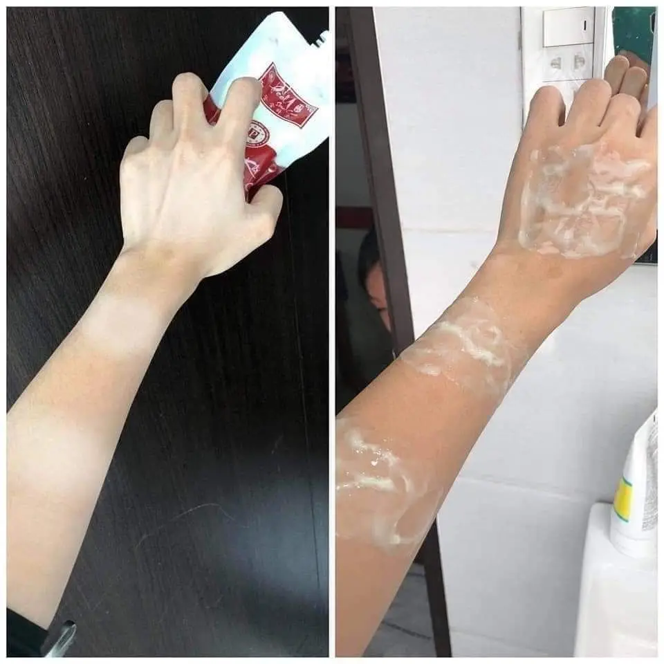 Вьетнамский отбеливающий лосьон - Фотография_4