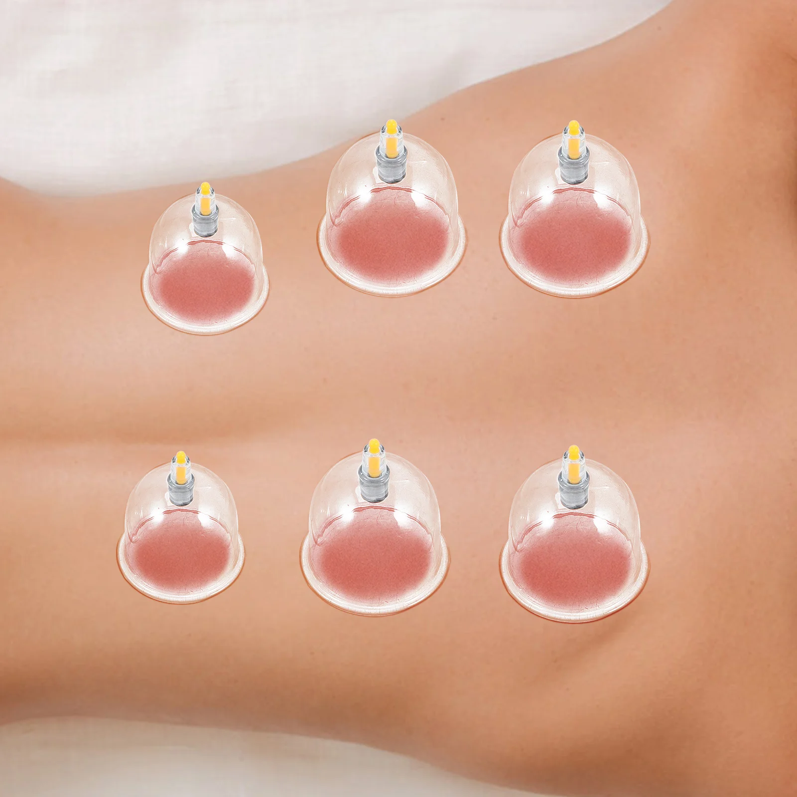 1 комплект, набор для вакуумной терапии - Фотография_6