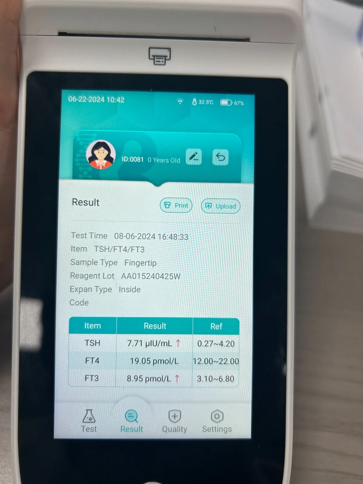 Тестирование функций печени ctni - Фотография_4