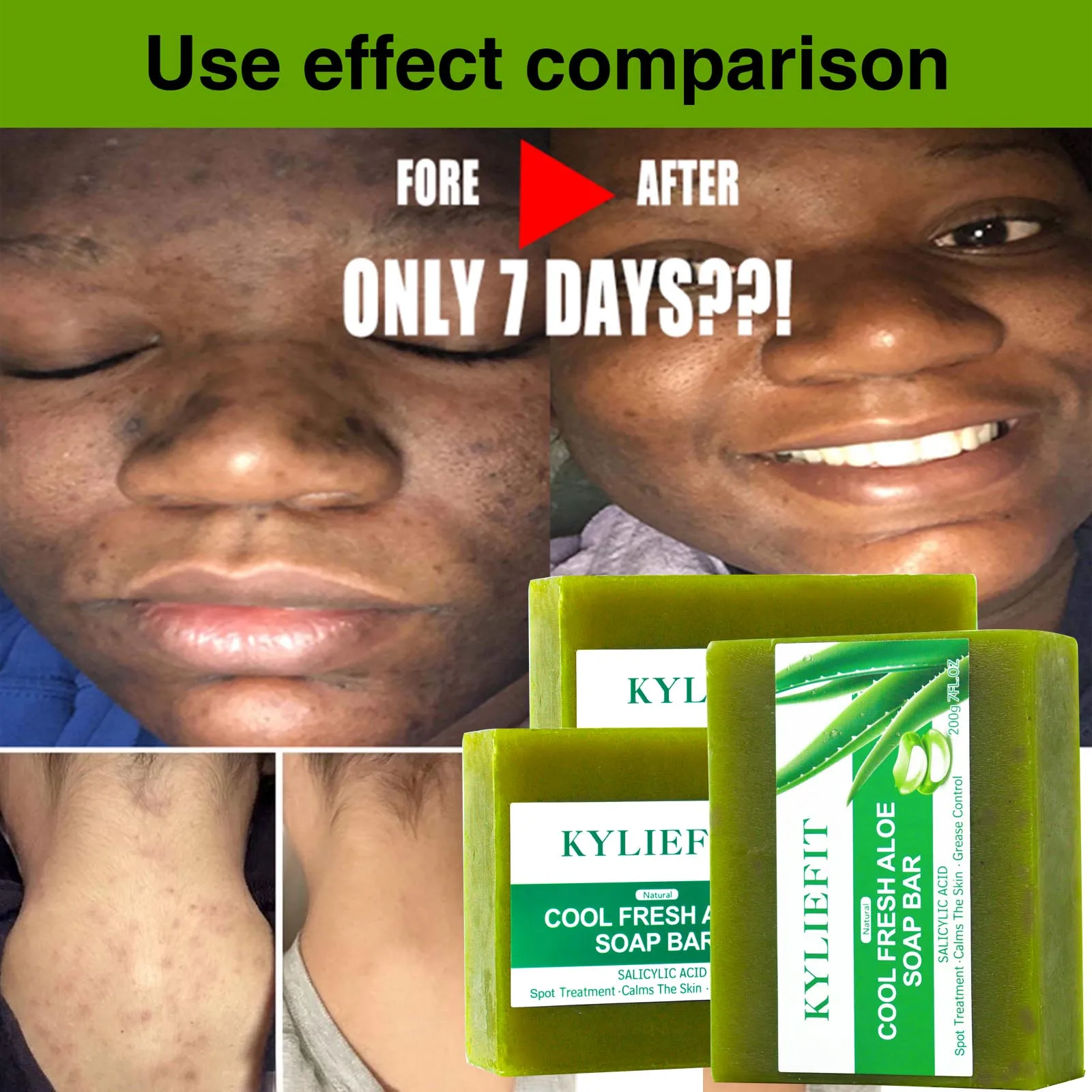 Отбеливающее мыло с алоэ вера ailke - Фотография_6