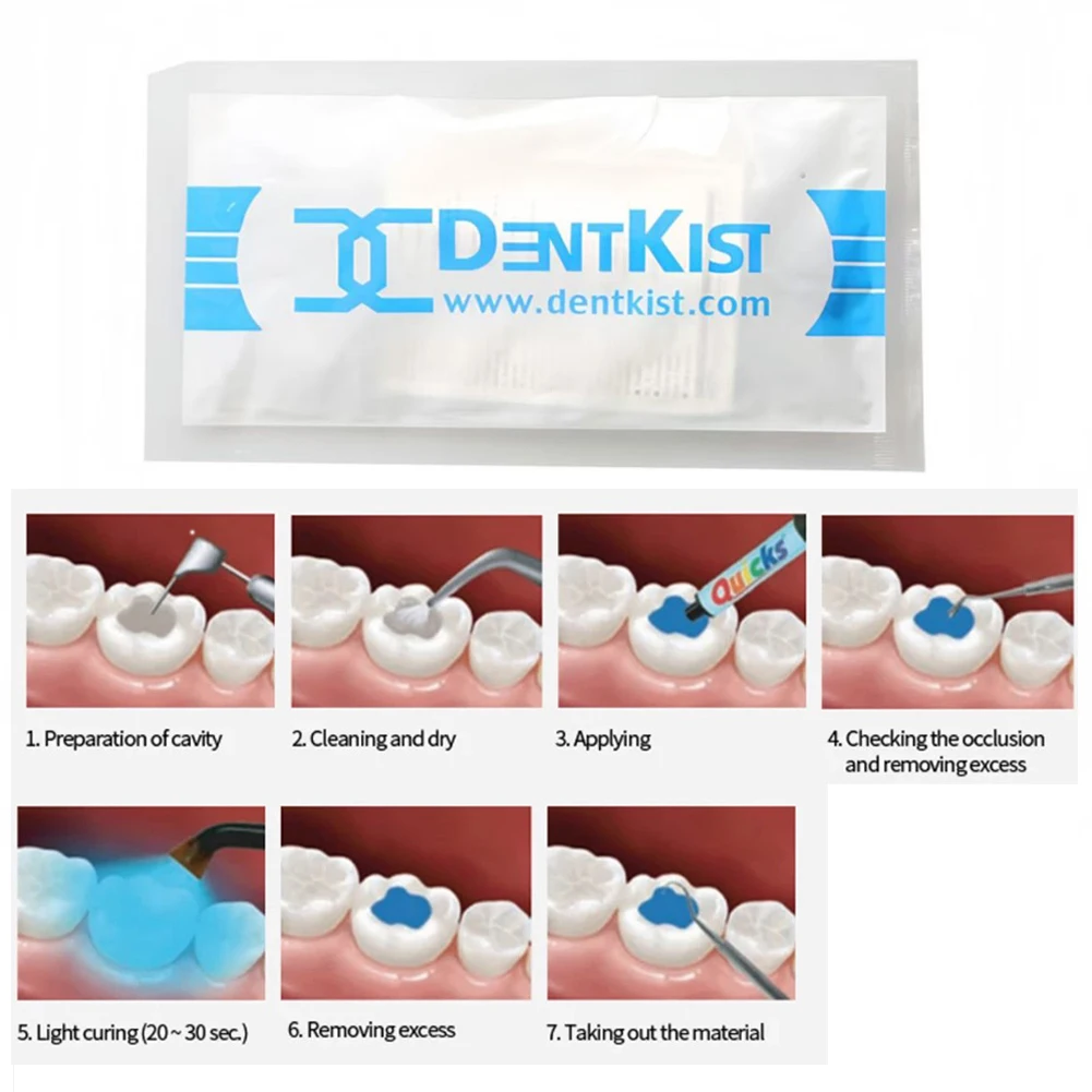 Dentkist светоотверждаемые временные материалы для наполнения - Фотография_4