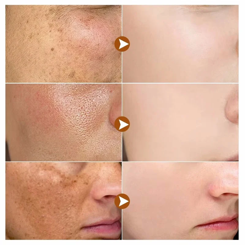 Отбеливающая сыворотка для удаления темных пятен - Фотография_3