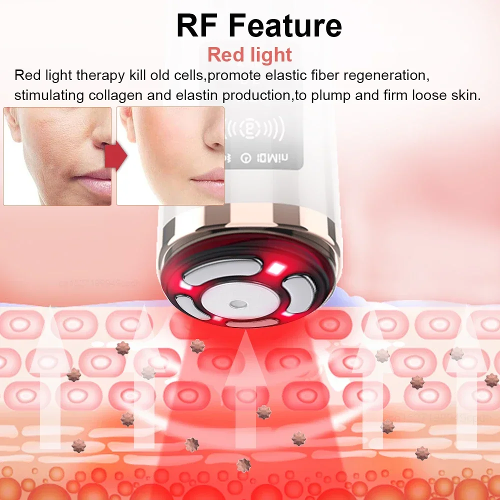 Hifu машина для лифтинга лица rf - Фотография_4