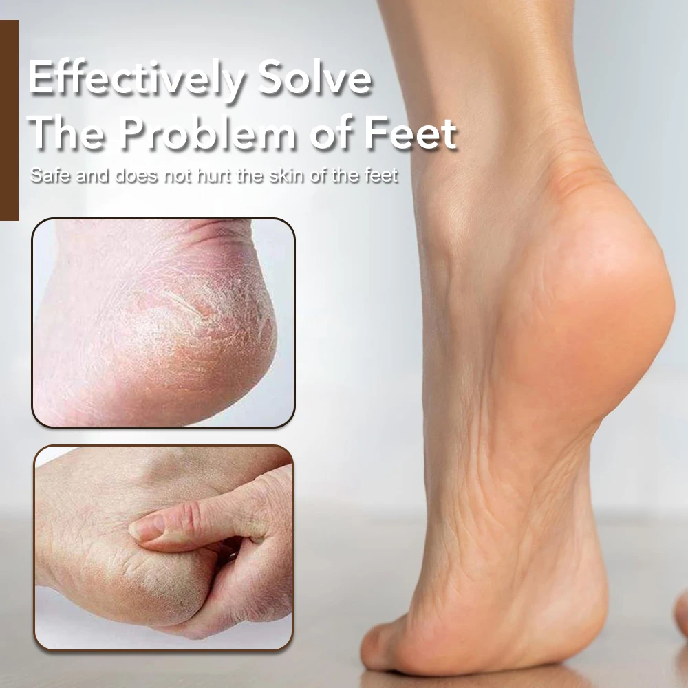 Инструмент для педикюра - Фотография_3