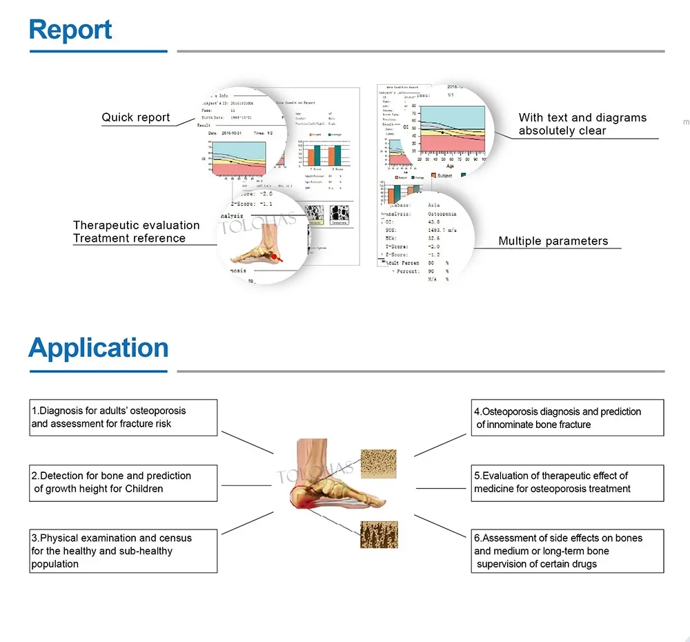 Lha3000s низкая цена медицинское - Фотография_5
