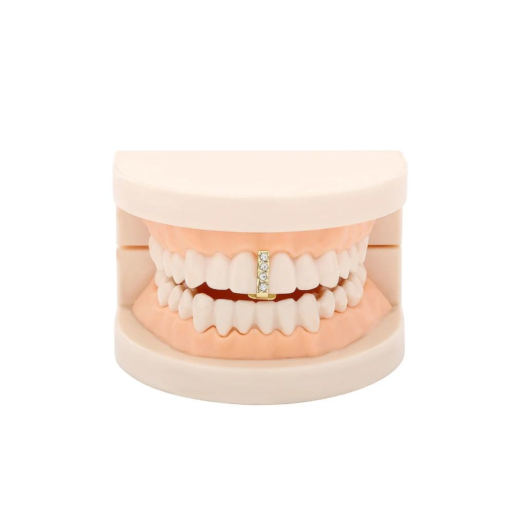 Модные шапочки для зубов - Фотография_5