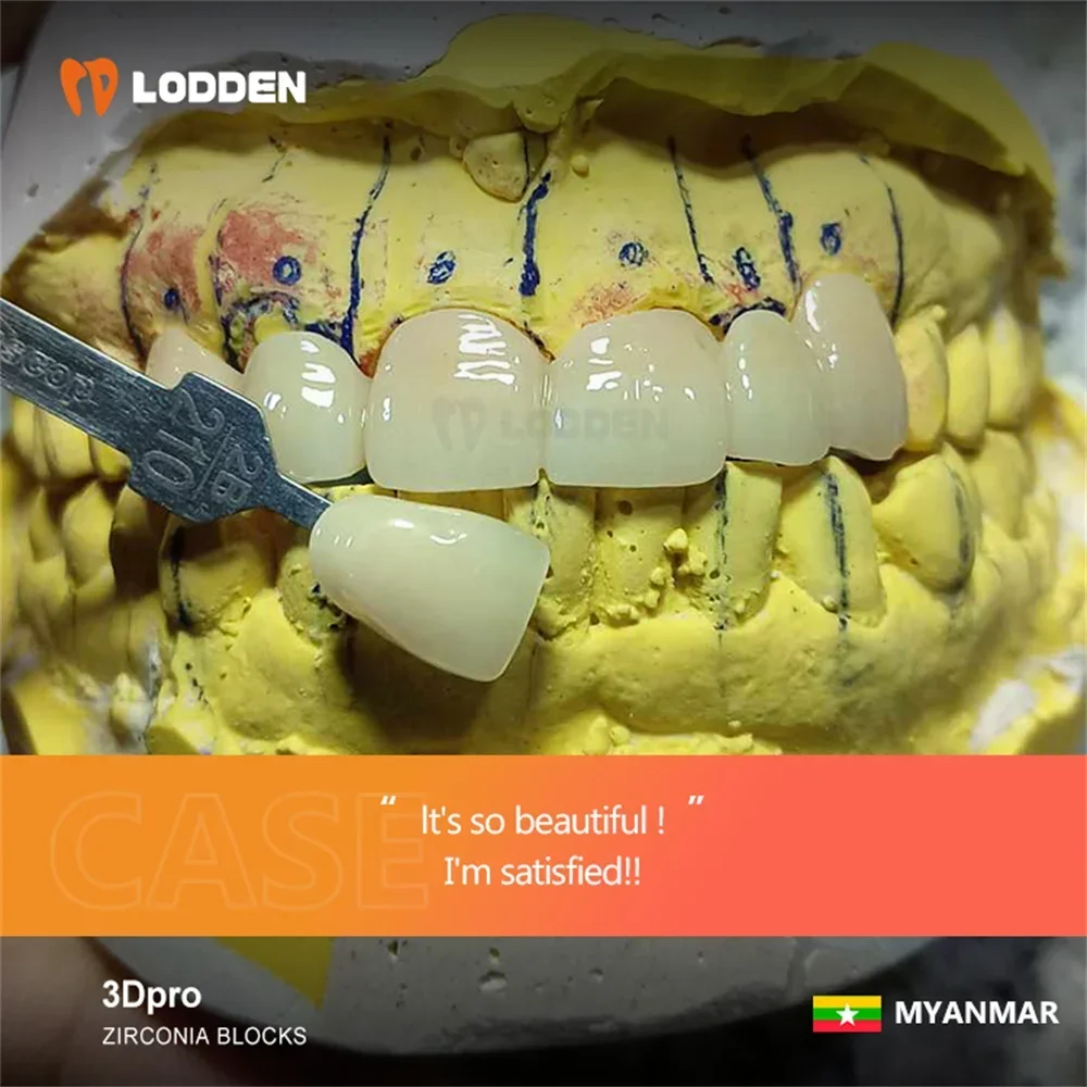 Многослойные блоки из циркония lodden 3d pro - Фотография_6