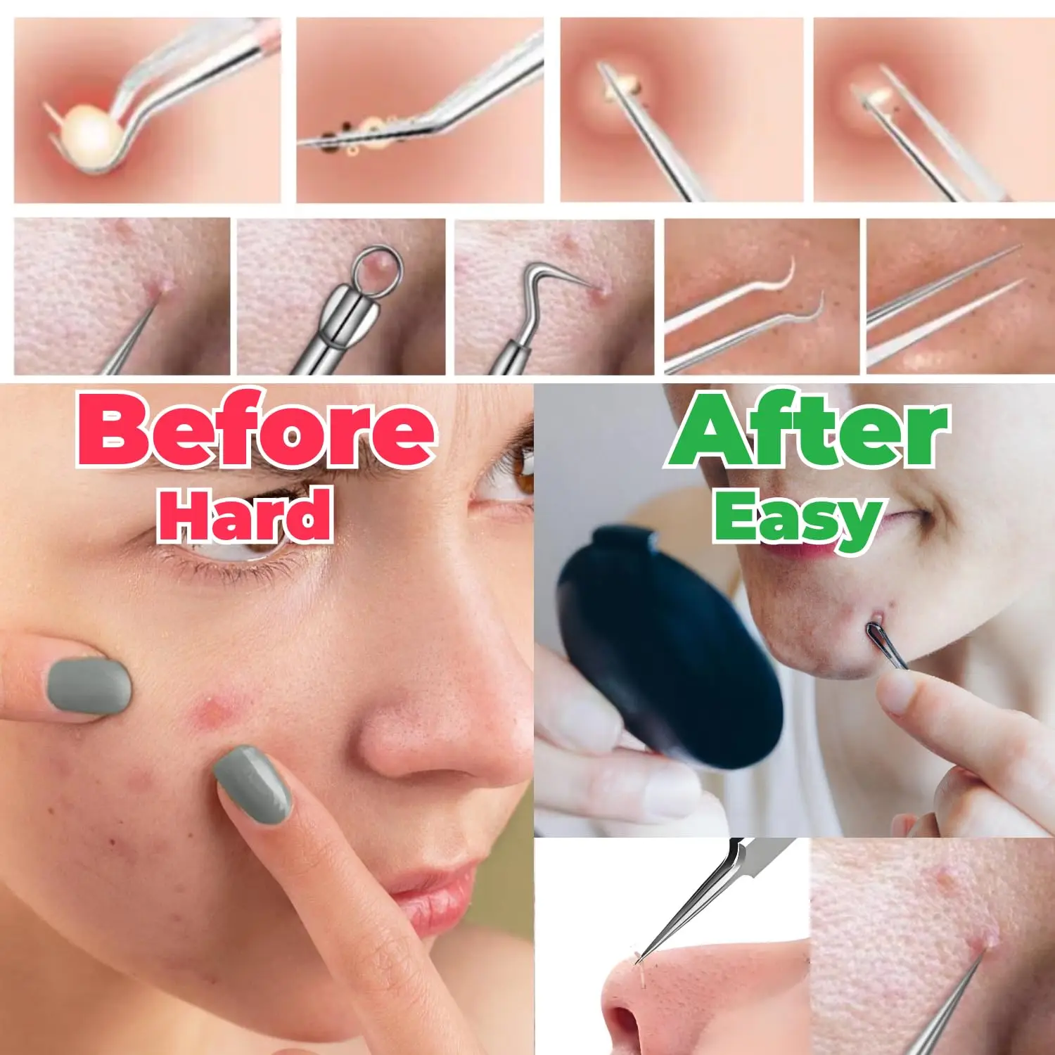 Зажим для удаления черных точек из пк - Фотография_3