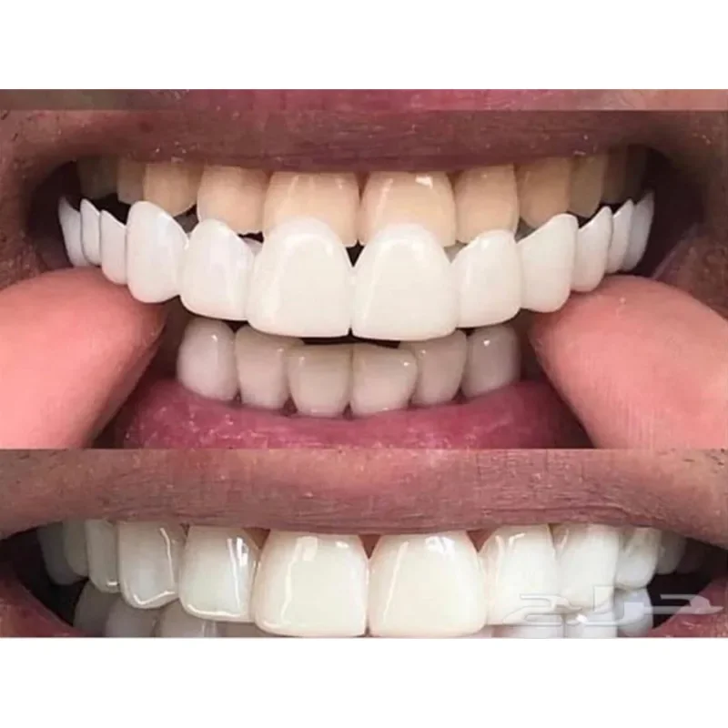 Силиконовый гель sowsmile perfect smile - Фотография_6