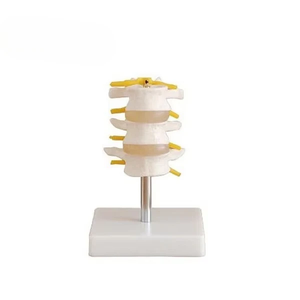 Модель поясницы со спинным шнуром и спинными нервами - Фотография_2