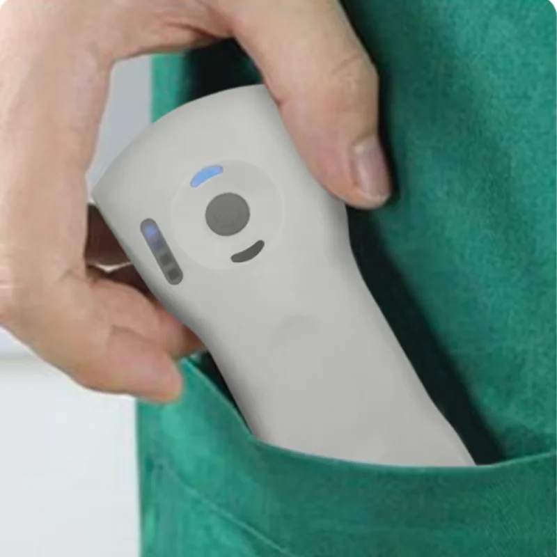 Беспроводной ультразвуковой сканер usg - Фотография_5