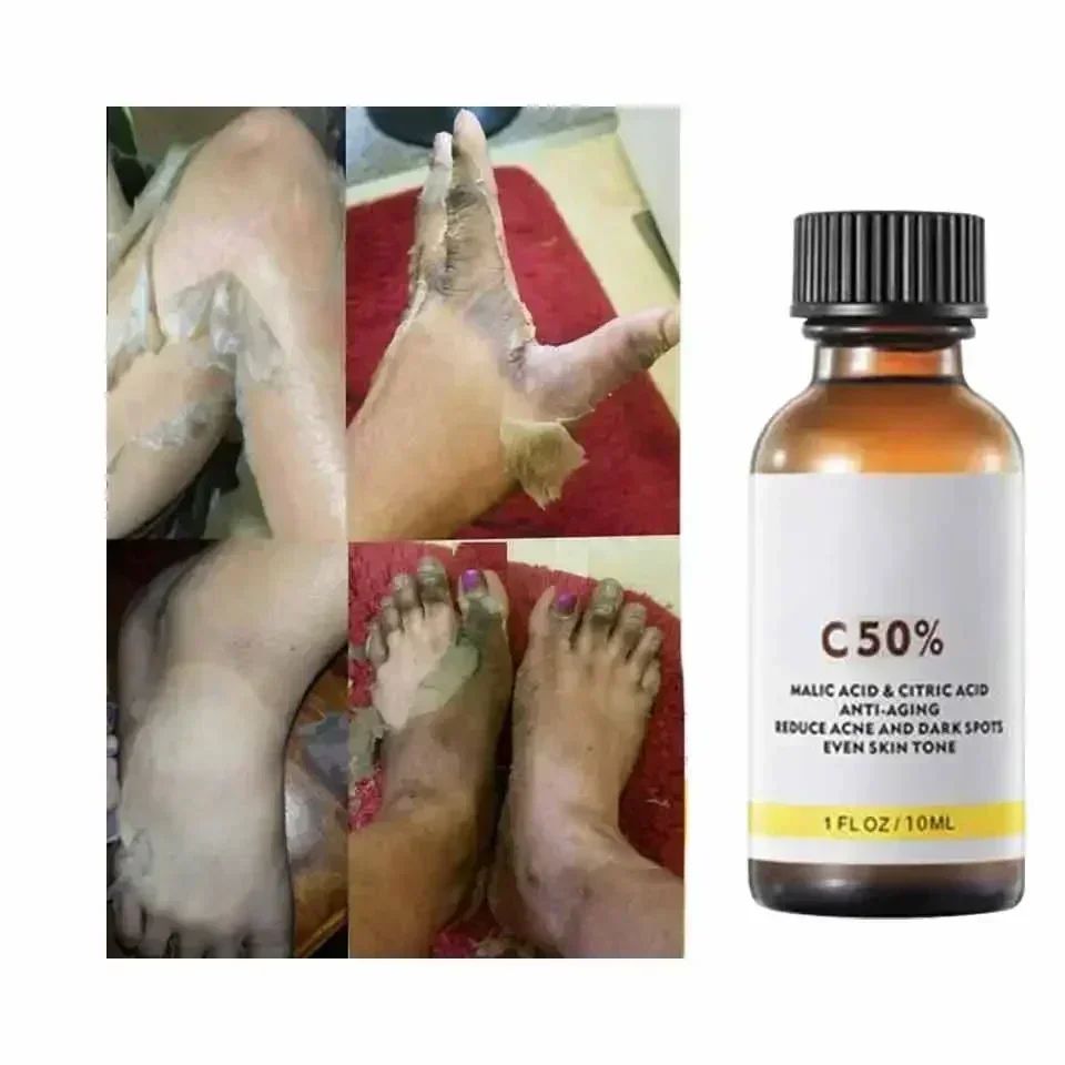 С яблочной кислотой и цирической - Фотография_5